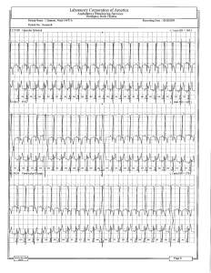 ECG