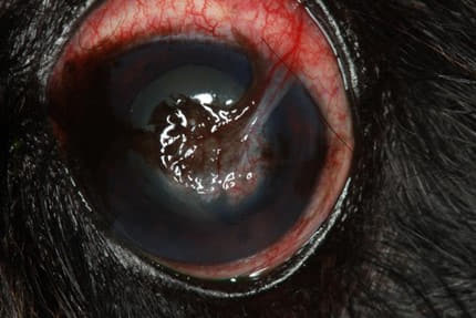 conjunctival_pedicle_graft